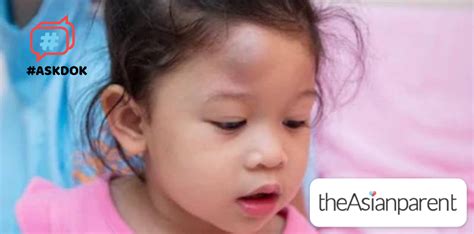Bukol Sa Ulo Ng Bata: Mga Importanteng Kaalaman .